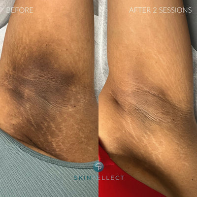 Andrea L. – Cuenca