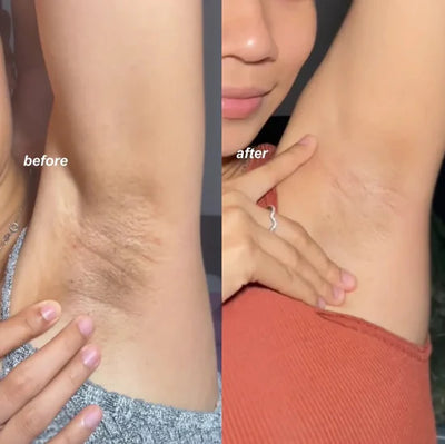 Karla (Axilas impecables)